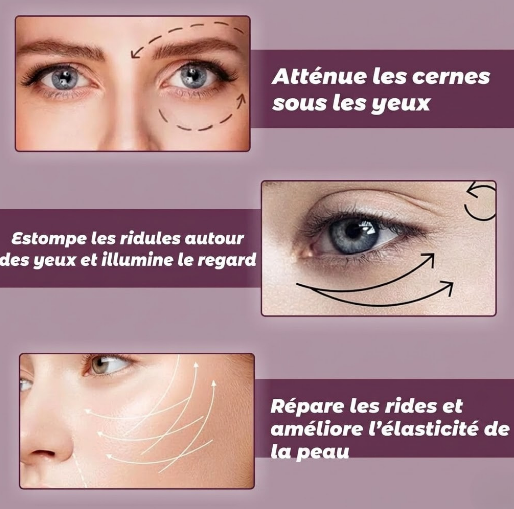1.	LumeaSkin