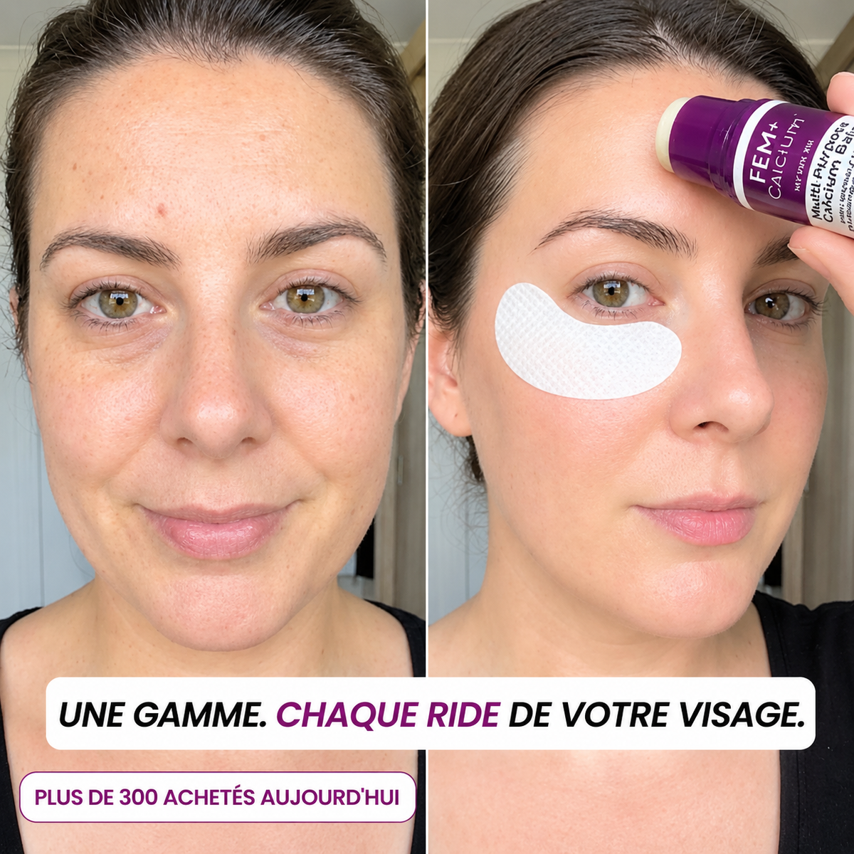 Routine coréenne en 3 étapes pour les cernes et les rides: du sourire